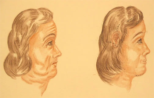 facial surgery facial surgery